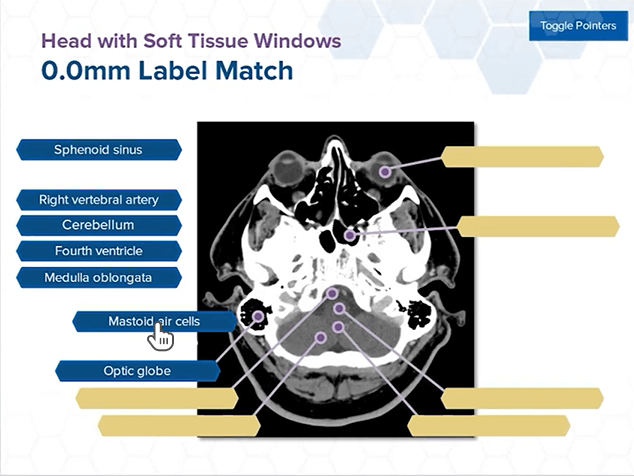 CAMRT interactive drag and drop exercise