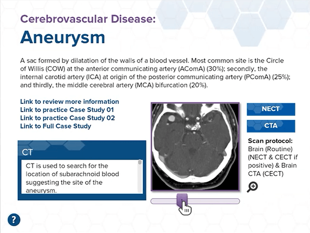 CAMRT slider interaction